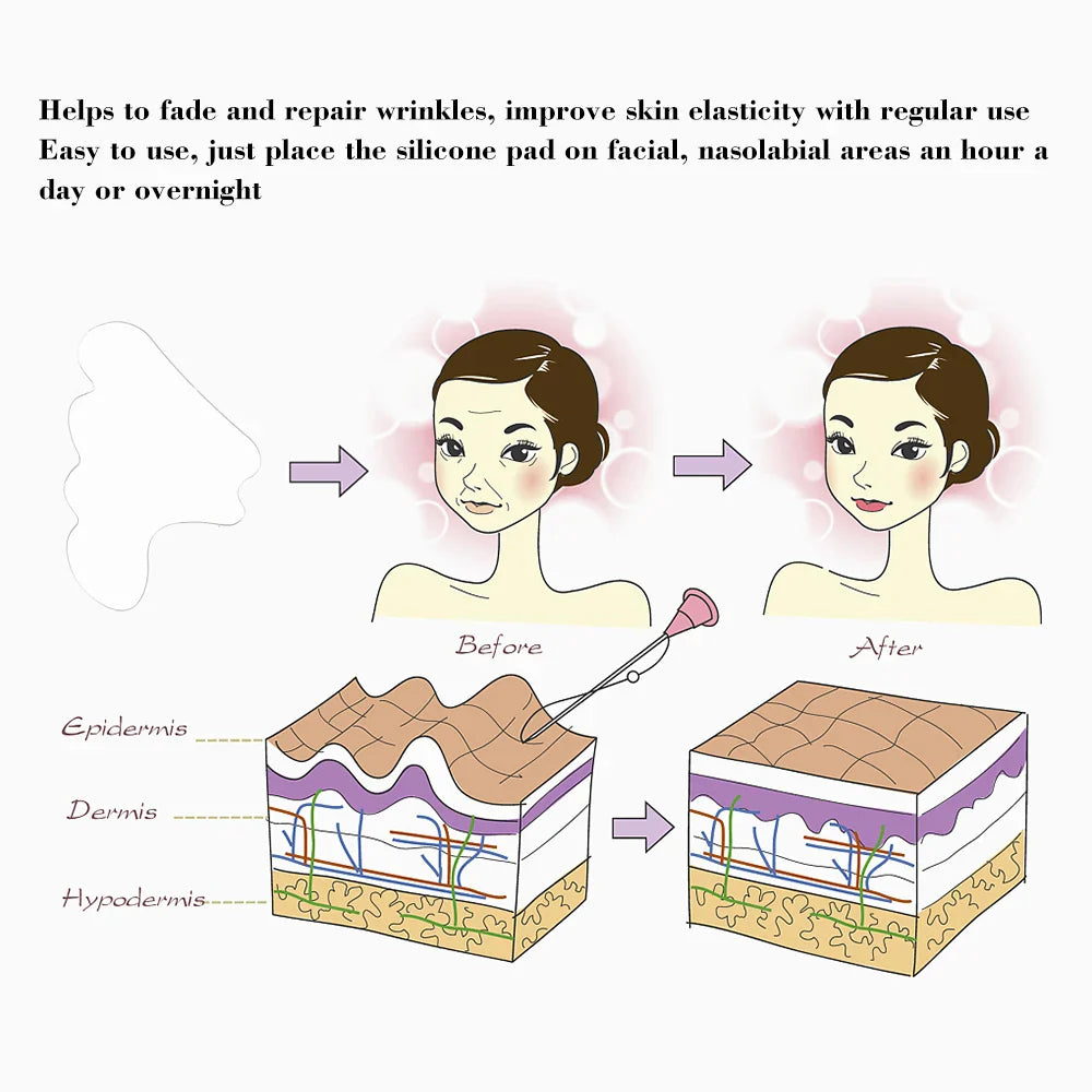 Facial Wrinkle Remover Pad Reusable Medical Grade Silicone Nasolabial Folds Anti-aging Mask Prevent Wrinkle Skin Lifting Patches