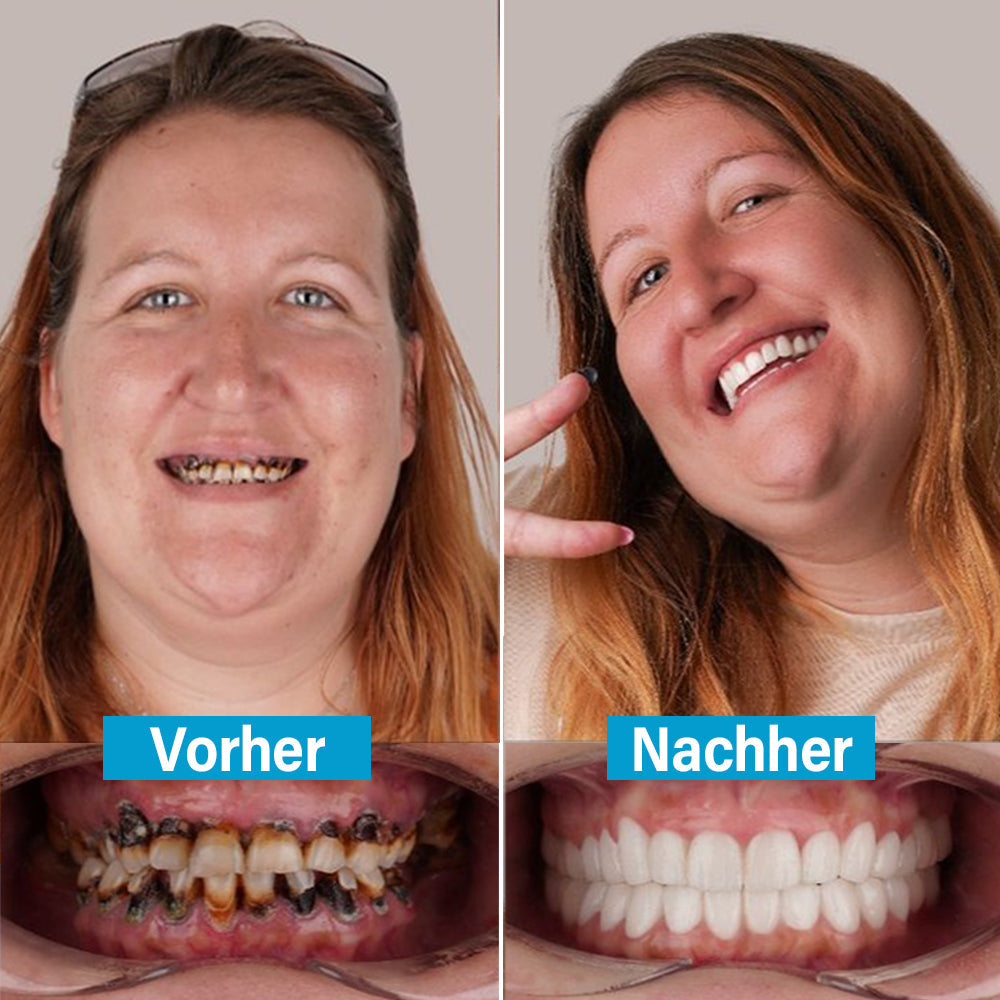 ✅ Hergestellt und versendet aus Deutschland | Ourlyard® Kokos- & Nelkenöl-Mundspülung (Repariert Zahnfleisch, behandelt Parodontitis, Mundgeruch und Mundgeschwüre)