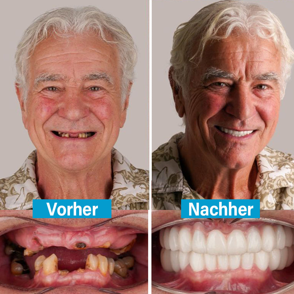 ✅ Hergestellt und versendet aus Deutschland | Ourlyard® Kokos- & Nelkenöl-Mundspülung (Repariert Zahnfleisch, behandelt Parodontitis, Mundgeruch und Mundgeschwüre)