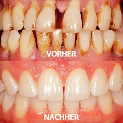 Rolimey® Transforming Growth Factor-β (TGF-β) Mundspülung zur oralen Reparatur