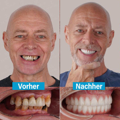 ✅ Hergestellt und versendet aus Deutschland | Ourlyard® Kokos- & Nelkenöl-Mundspülung (Repariert Zahnfleisch, behandelt Parodontitis, Mundgeruch und Mundgeschwüre)