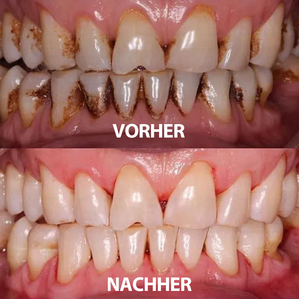 Rolimey® Transforming Growth Factor-β (TGF-β) Mundspülung zur oralen Reparatur