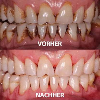 Rolimey® Transforming Growth Factor-β (TGF-β) Mundspülung zur oralen Reparatur