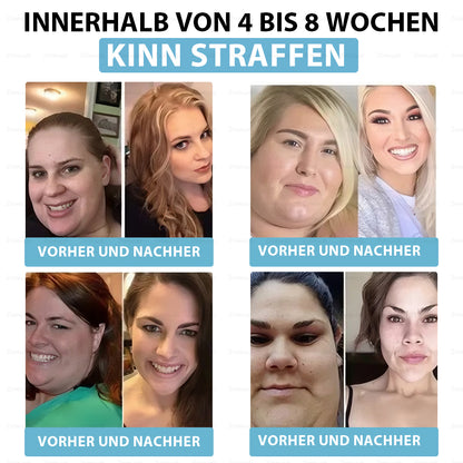 Offizieller Shop | Zvoevo® Slim & Vitality Tirzepatid-Orallösung