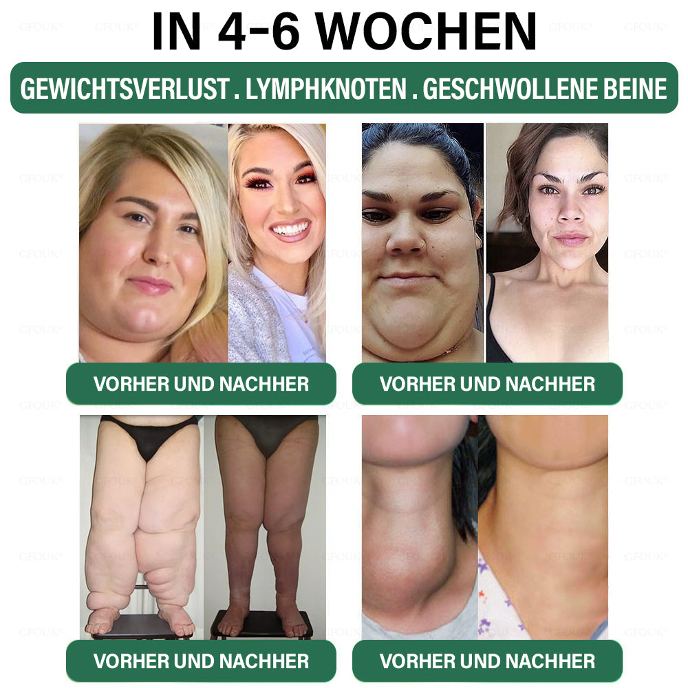 ✅ Hergestellt und versendet aus Deutschland | GFOUK® 𝐆𝐋𝐏-𝟏 Schlankheits- & Gesundheit Nasenring｜⚡ Schnelles Fettverbrennen & Stoffwechselbalance