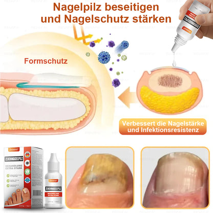 ✅ Hergestellt und versendet aus Deutschland | Zvoevo® Extra Starkes Nagelpilz-Behandlungsmittel, Antimykotische Lösung für Zehen- oder Fingernägel-up
