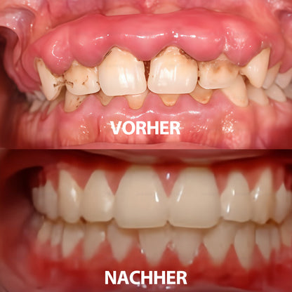 Rolimey® Transforming Growth Factor-β (TGF-β) Mundspülung zur oralen Reparatur
