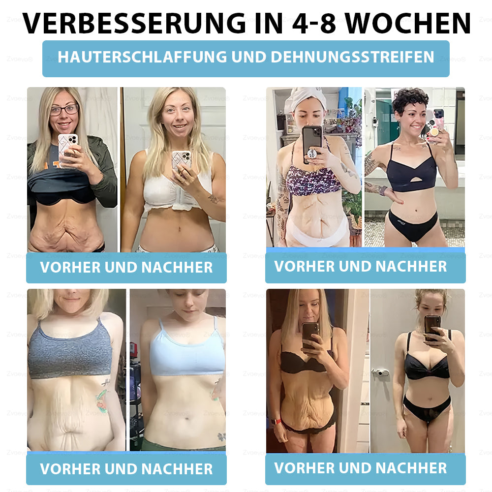 Offizieller Shop | Zvoevo® Slim & Vitality Tirzepatid-Orallösung