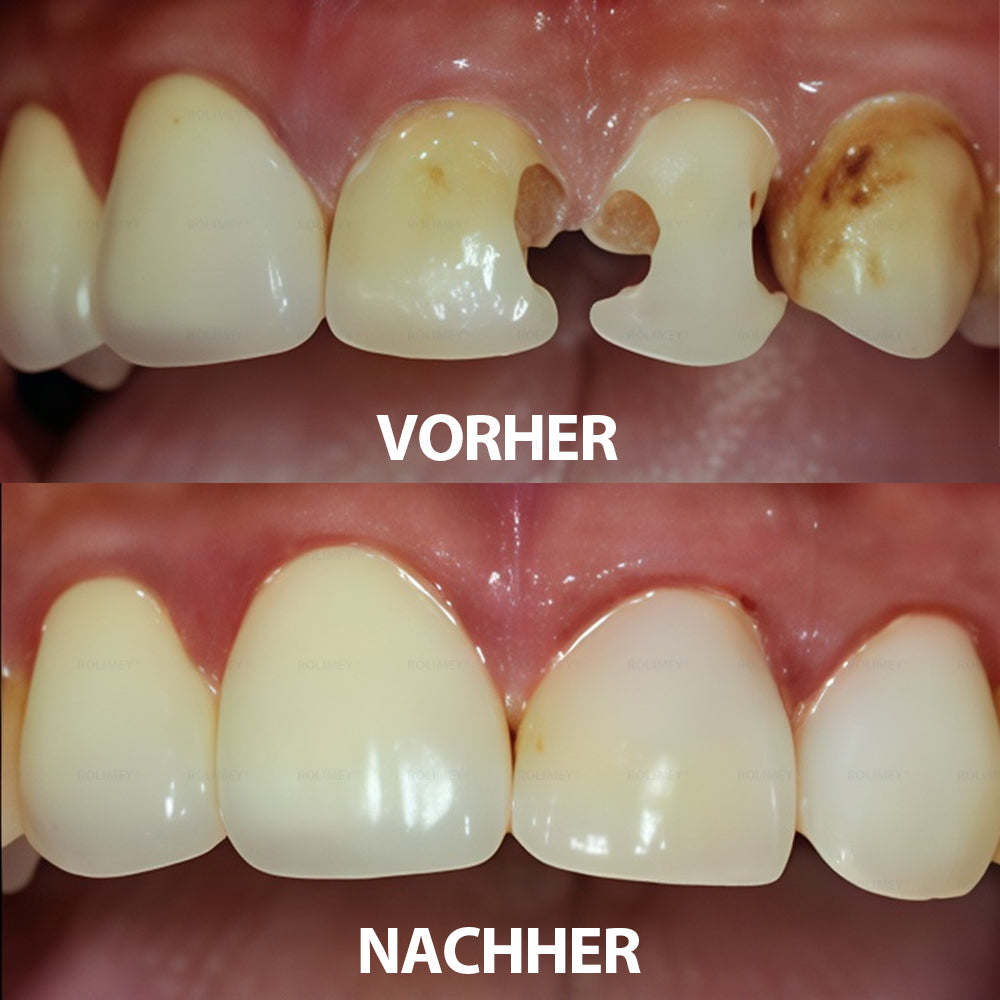 Rolimey® Transforming Growth Factor-β (TGF-β) Mundspülung zur oralen Reparatur