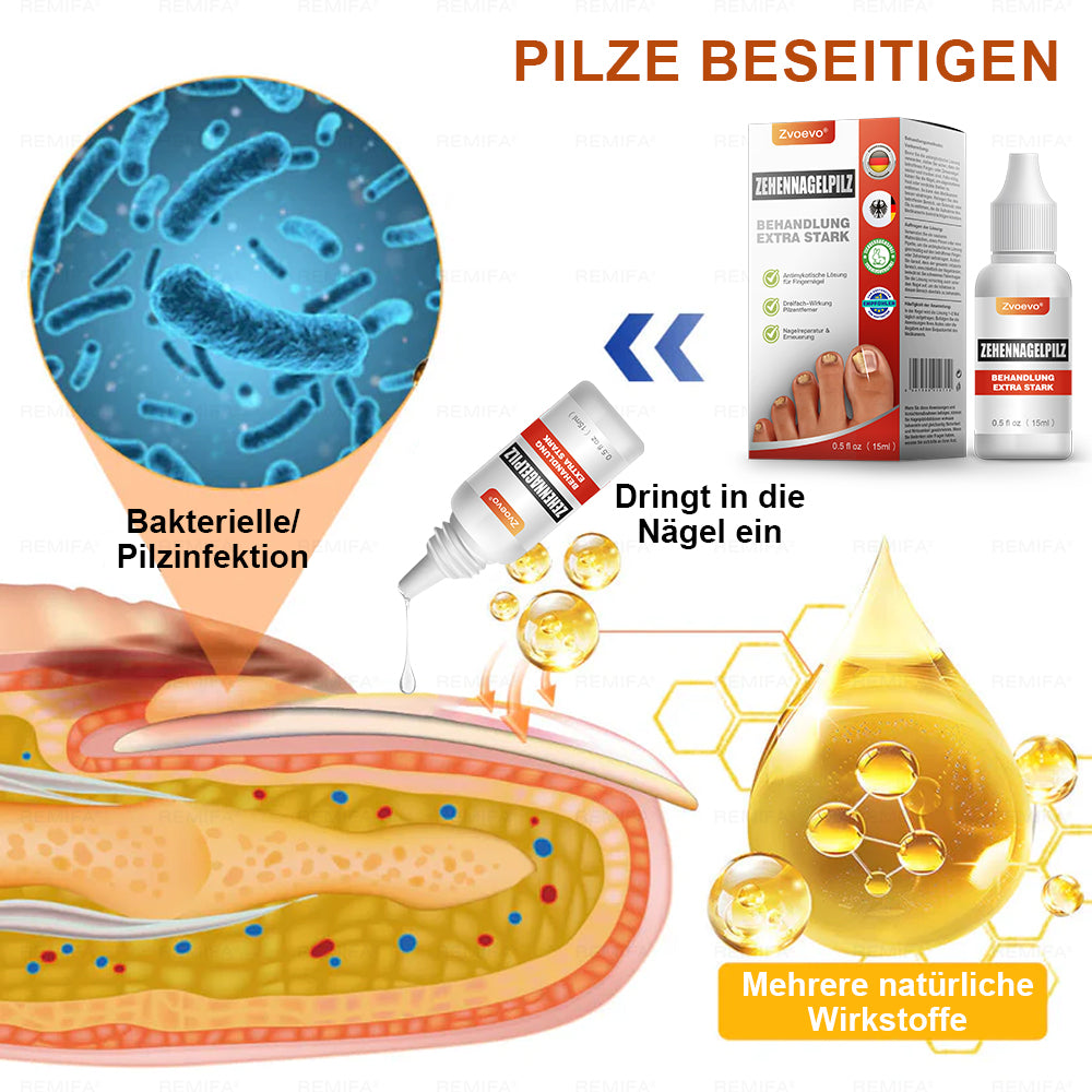 ✅ Hergestellt und versendet aus Deutschland | Zvoevo® Extra Starkes Nagelpilz-Behandlungsmittel, Antimykotische Lösung für Zehen- oder Fingernägel-up